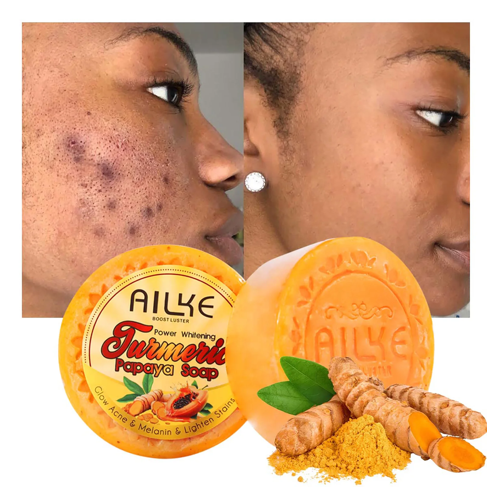 AILKE Lightening Soap Bar for Women, With Natural Turmeric, Papaya, Carrot, Remove Dark Spots, Acne, for All Skin Types, 200g