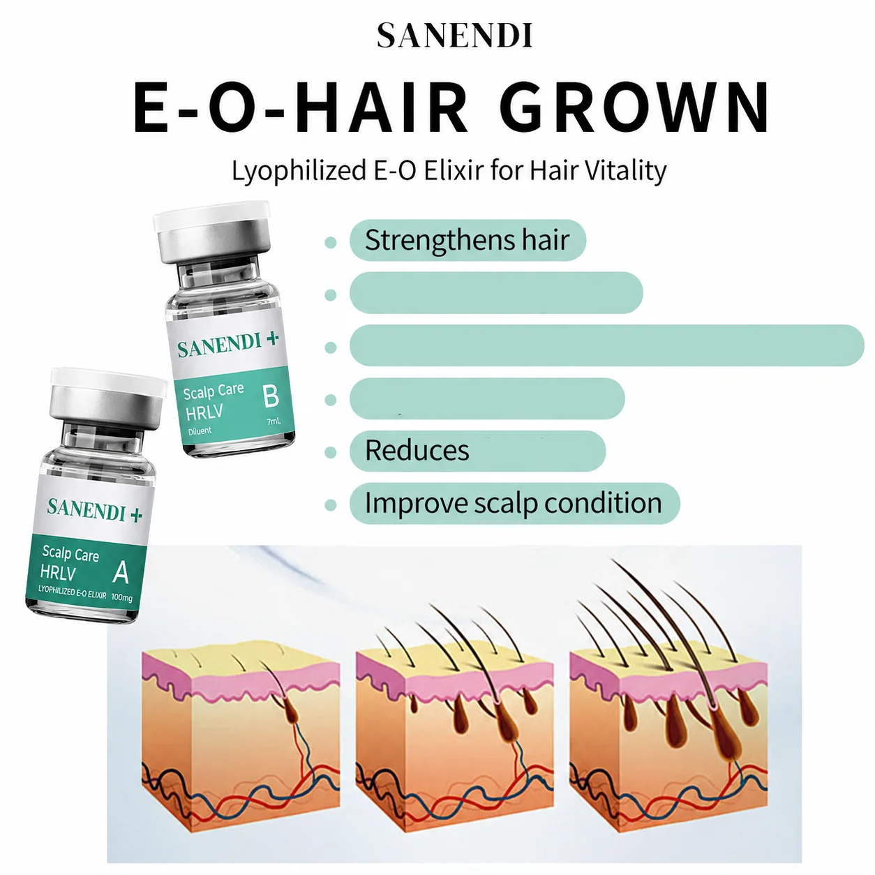 Hot Sale Sanendi EXOME Scalp Care Hair Boost Lotion Improve Scalp Condition Serum HRLV Lyophilized E-OME South Korea Hair Care