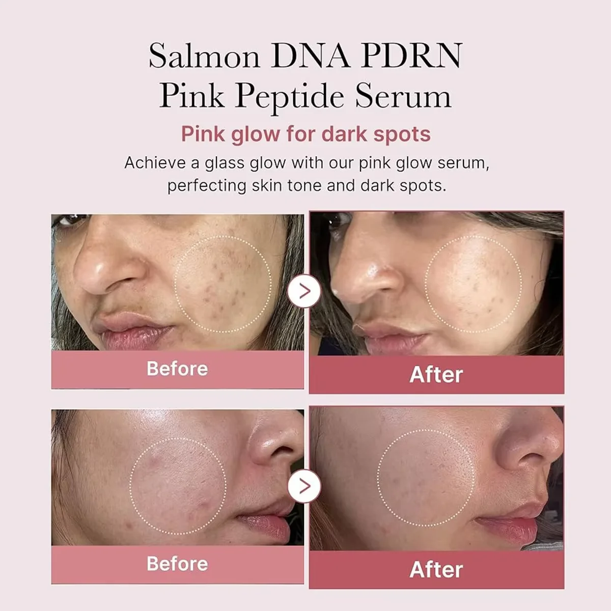 Medicube Salmon DNA PDRN Pink Peptide Serum,Serum Texture,Complex Repair Ingredients,Lifting & Firming,K-Beauty,Korean Makeup