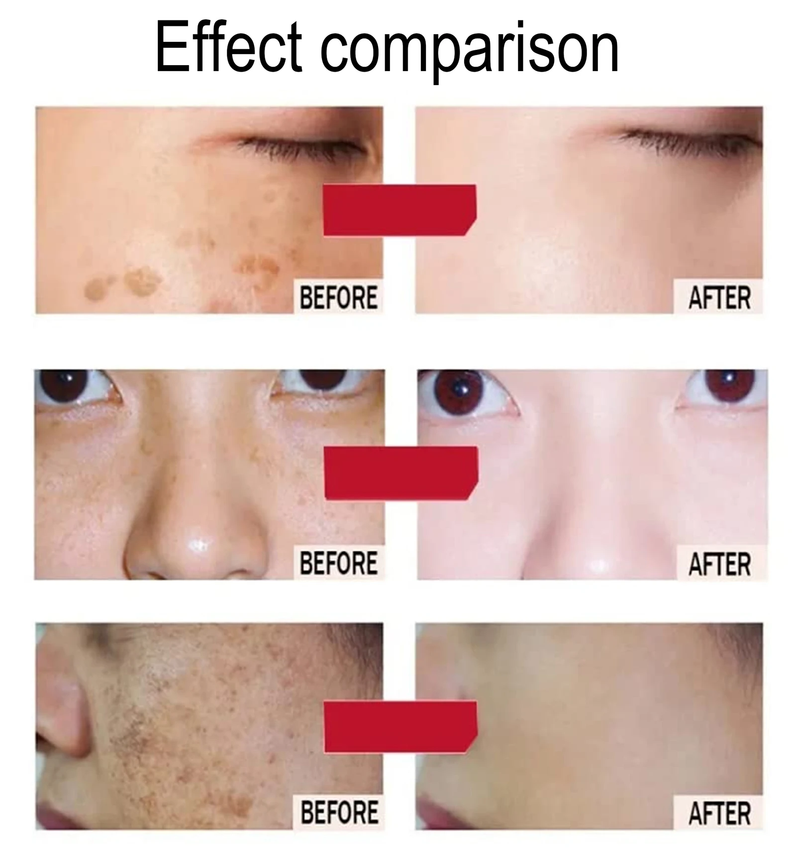 AILKE Whitening Facial Skincare For Women, With Niacinamide, Kojic Acid, Reduce Dark Spots, Hyperpigmentation, Uneven Skin Tone