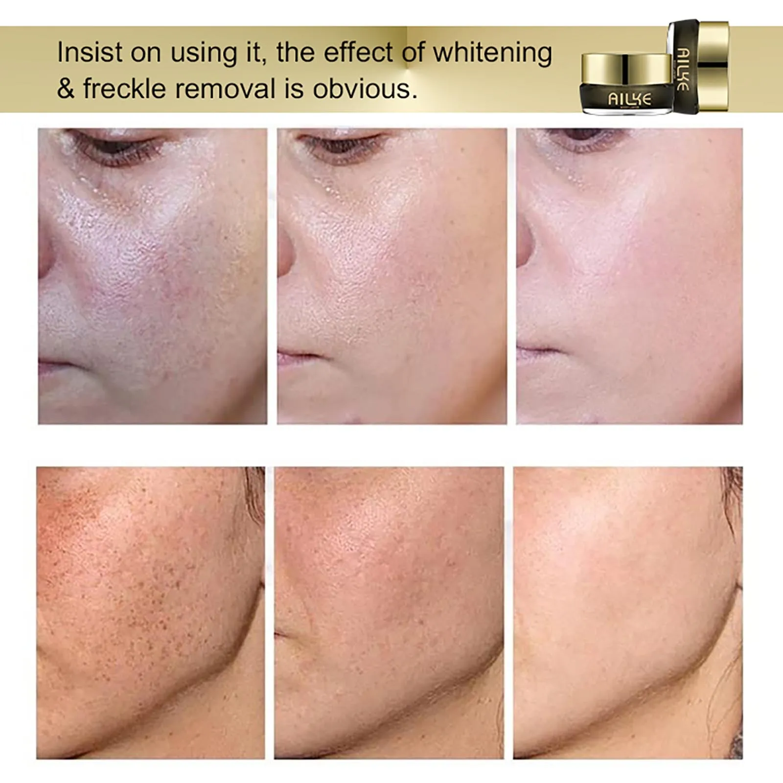 AILKE Whitening Facial Skincare For Women, With Niacinamide, Kojic Acid, Reduce Dark Spots, Hyperpigmentation, Uneven Skin Tone