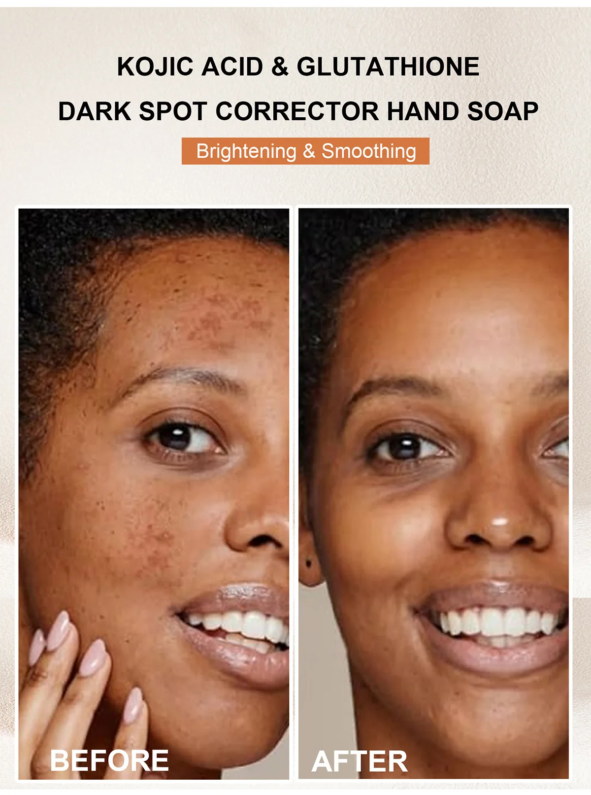 WK JALY Kojic Acid Whitening Soap Bar, With Glutathione, Vitamin C, Dark Spot Corrector, Even Skin Tone,  For Face, Body 200g