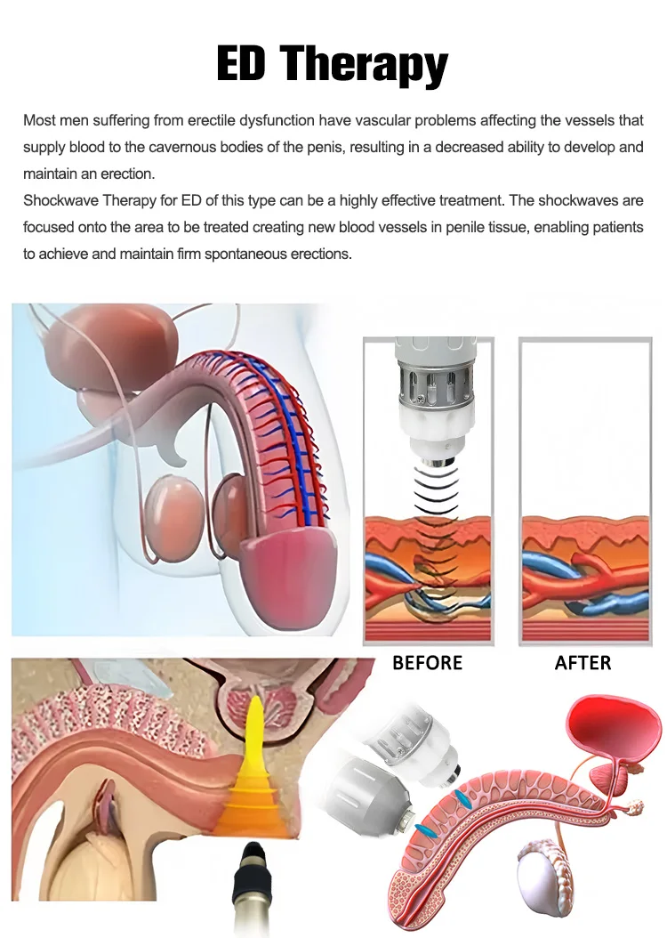 2-in-1 Shockwave Therapy Machine Body Pain Relief Physiotherapy Rehabilitation Equipment