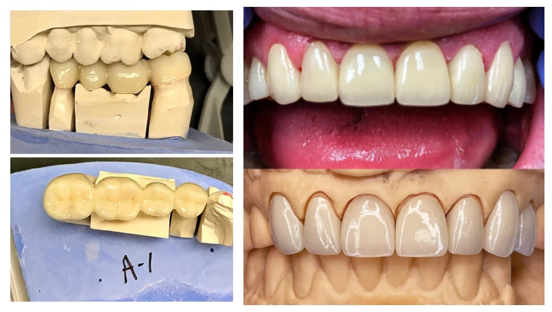 CE ISO Zirconia block HT High Transparent Dental White Ceramics Zirconia Disc