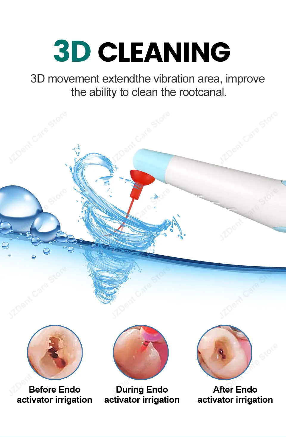 Twoendo Dental Instrument Endo Cleaning Odontologia Sonic Irrigator Dentistry Sonic Activator With 30/90pcs Tips For Root Canal
