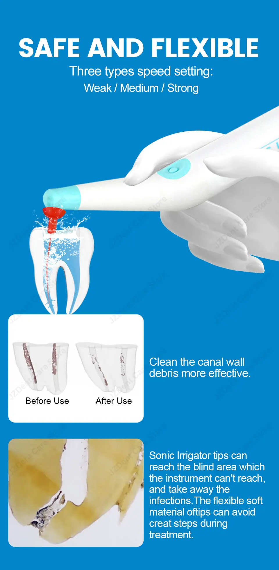 Twoendo Dental Instrument Endo Cleaning Odontologia Sonic Irrigator Dentistry Sonic Activator With 30/90pcs Tips For Root Canal
