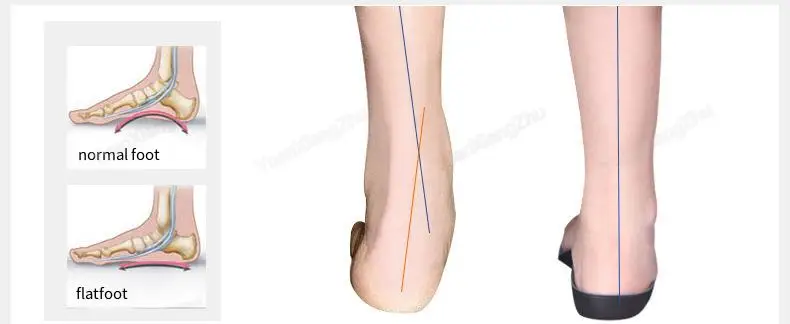 Arch Support Insole for Feet Men Women Orthopedic Insoles for Shoes Comfortable Shock-absorbing Inserts Sport Running Shoe Sole