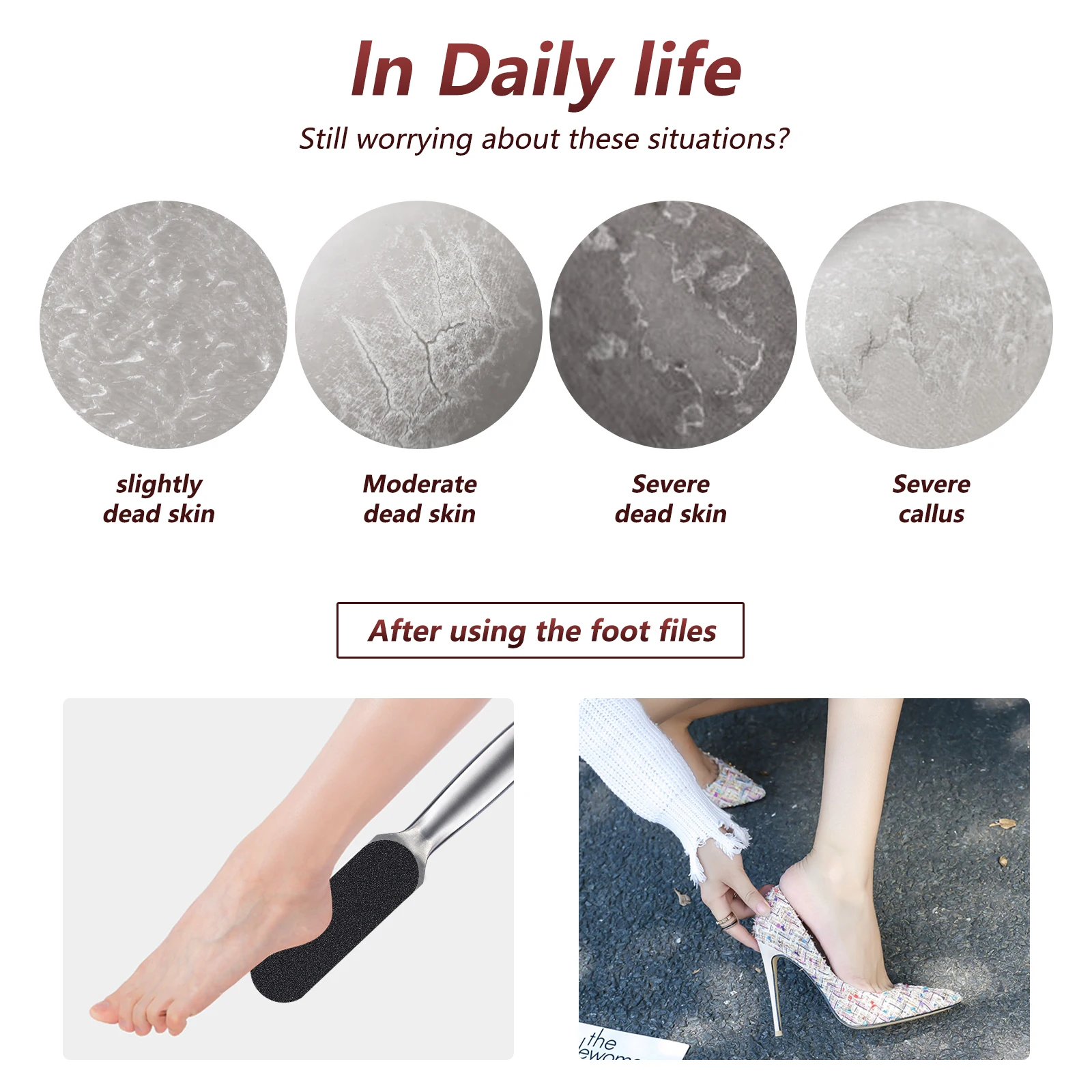 20PCS Pedicure File Refill Pads Callus Remover Foot Files Pedi File Replacement for Reusable Stainless Steel Foot Rasp Handle