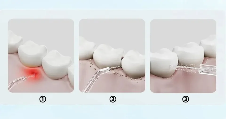 Mijia Electric Oral Irrigator F300 Dental Water Jet Portable Powerful Pick Flosser Teeth Whitening Cleaner Mouth Cleanner