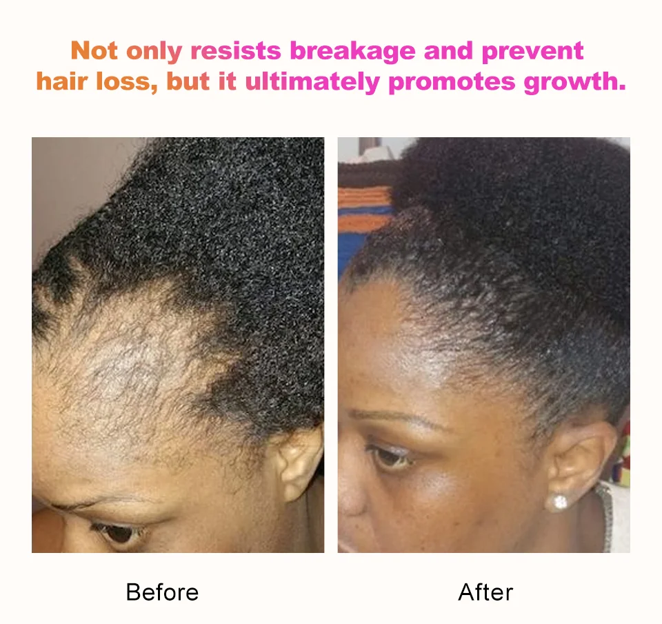 100% Chebe Powder Natural Ingredients Promotes Strong and Healthy Hair Strengthens Fast Hair Regrowth Anti Hair Loss Treatment