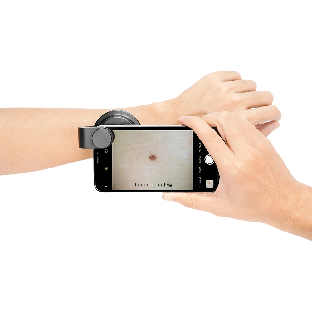 Polarized Optical 10X Skin Magnifier Smartphone Dermatoscope DE-400 pocket round dermoscopy for home use