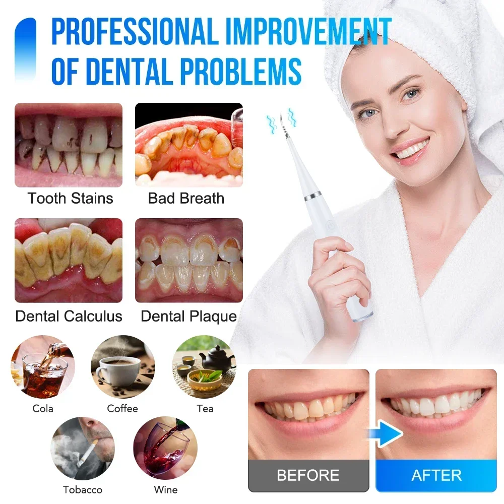 Ultrasonic Scaler for Teeth Cleaning Tartar Removal Plaque Removal Rechargeable Teeth Whitening Oral Care and Dental Cleaner