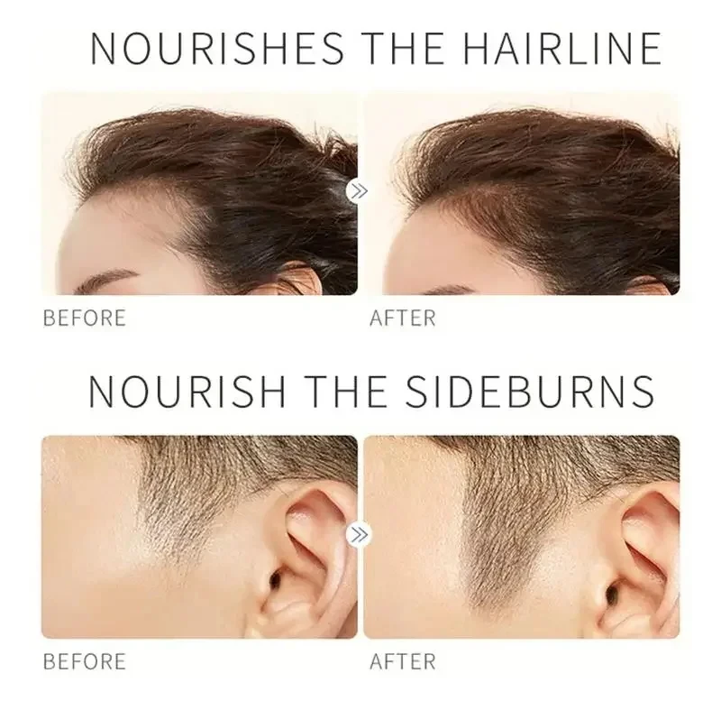 Fast Eyebrow Growth Serum Eyelash Hair Growth Anti Hairs Loss Product Prevent Baldness Fuller Thicker Lengthening Eyebrow Makeup