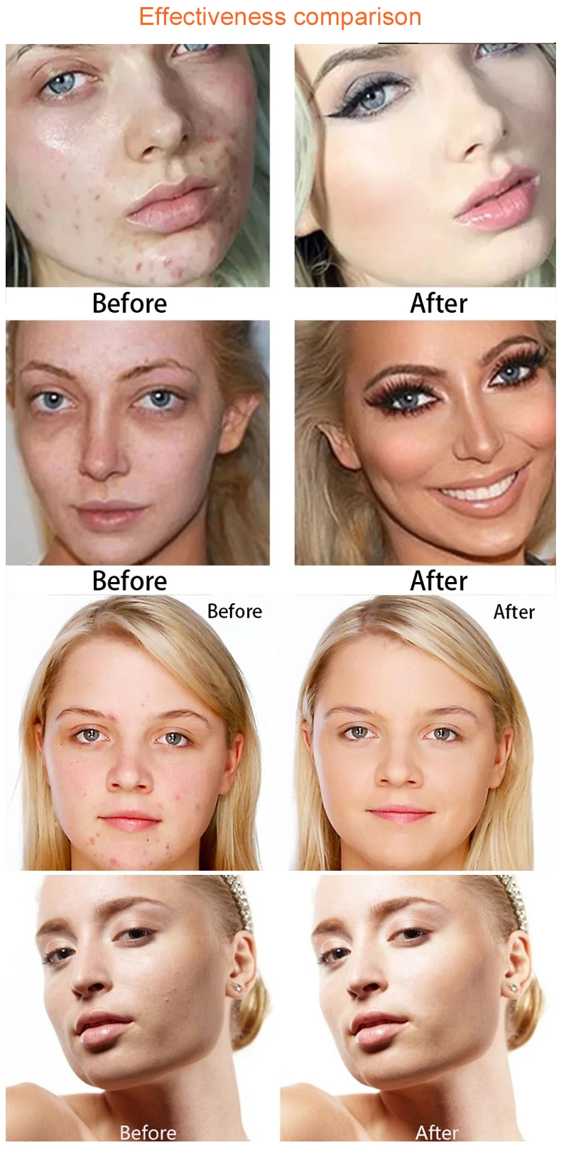 15 Colors Face Concealer Camouflage Cream Contour Palette Maquillaje Profesional Foundation Paleta Concealer