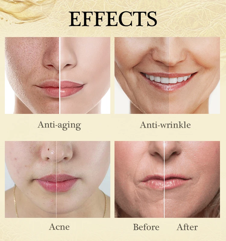 Niacinamide Face Serum 24K Gold Hyaluronic Acid Essence Whitening Dark Spot Corrector Facial Serum Skin Care Products
