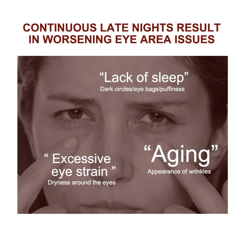 Astaxanthin Dark Circles Remover Eye Bags Eye Cream Anti Wrinkle Firmness Moisturizing Eyes Serum Skin Care Beauty Products