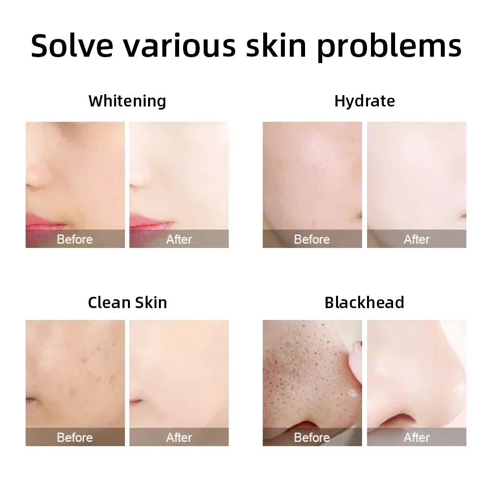 AOKO 7 in 1 H2O2 Hydro Dermabrasion Facial Machine Water Oxygen Skin Cleaning Lifting Professional Aqua Peeling Beauty Device