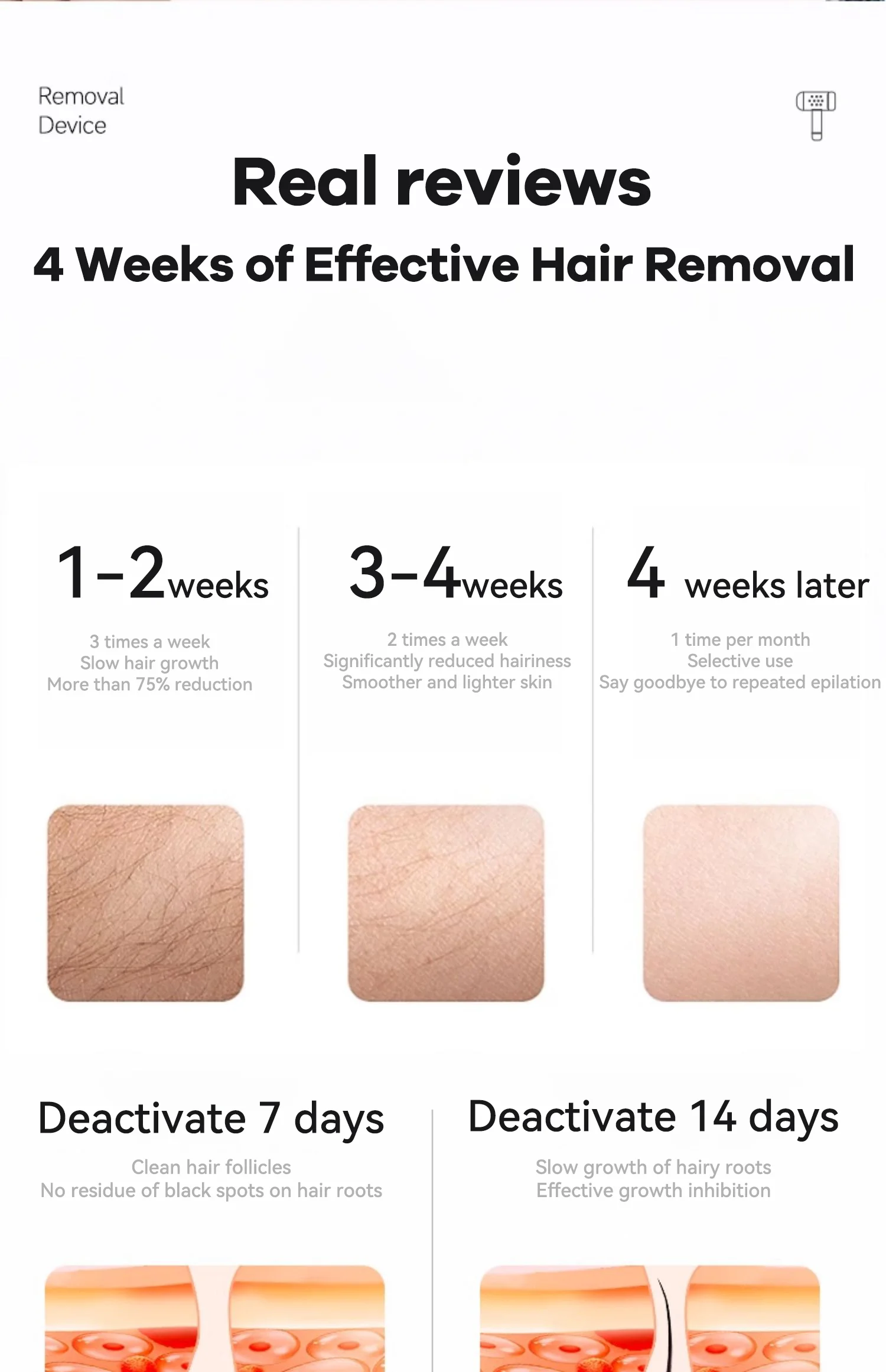 Sapphire Cooling IPL Hair Removal 10℃ Skin Temp Control Painless Safe Permanent Smart Sensor Hair Remover For Women Men Body