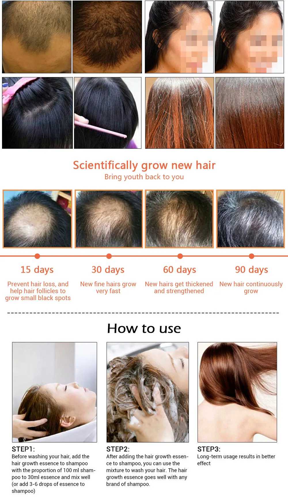 Andrea Hair Fast Hair Growth Essentielle Herbal Keratin Dense Alopecia Loss Liquid Ginger Sunburst Yuda Pilatory Oil 20ml