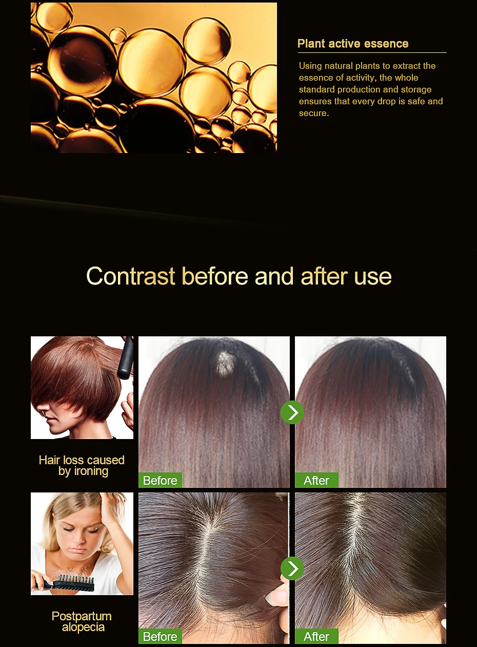 Andrea Hair Fast Hair Growth Essentielle Herbal Keratin Dense Alopecia Loss Liquid Ginger Sunburst Yuda Pilatory Oil 20ml