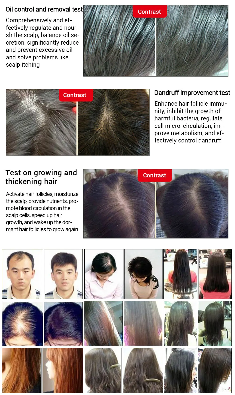Andrea Hair Fast Hair Growth Essentielle Herbal Keratin Dense Alopecia Loss Liquid Ginger Sunburst Yuda Pilatory Oil 20ml
