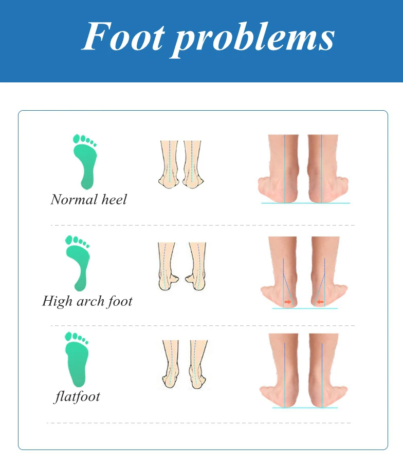 Sports Orthopedic Insoles Flat Foot Orthopedic Arch Support Insole Men and Women Shoe Pad EVA Sports Insert Sneaker Cushion Sole