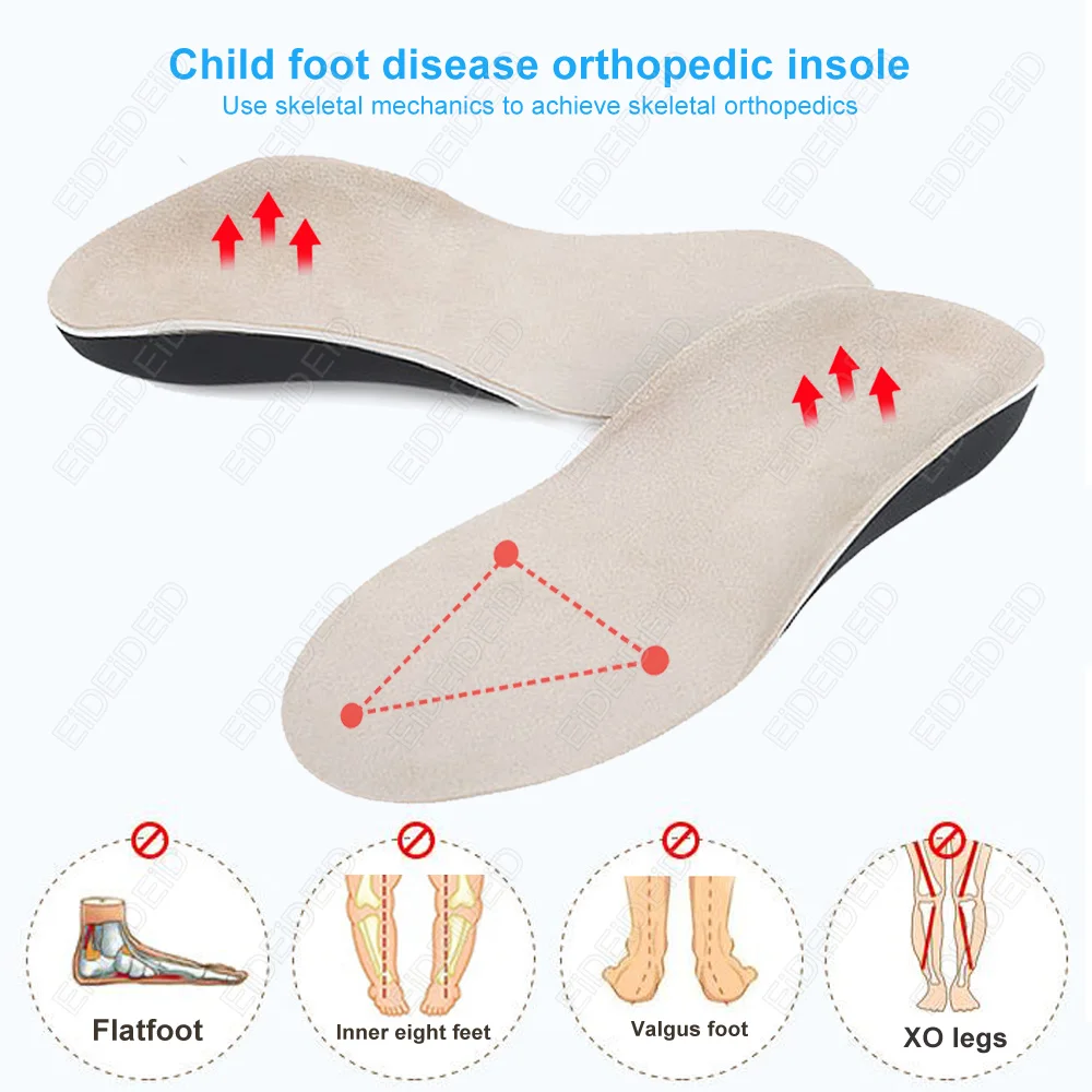 3D Orthotic Insoles Flat Feet for Kids Children and Adults Arch Support Insole for X Legs Orthotic Shoe Heel Pad Inserts