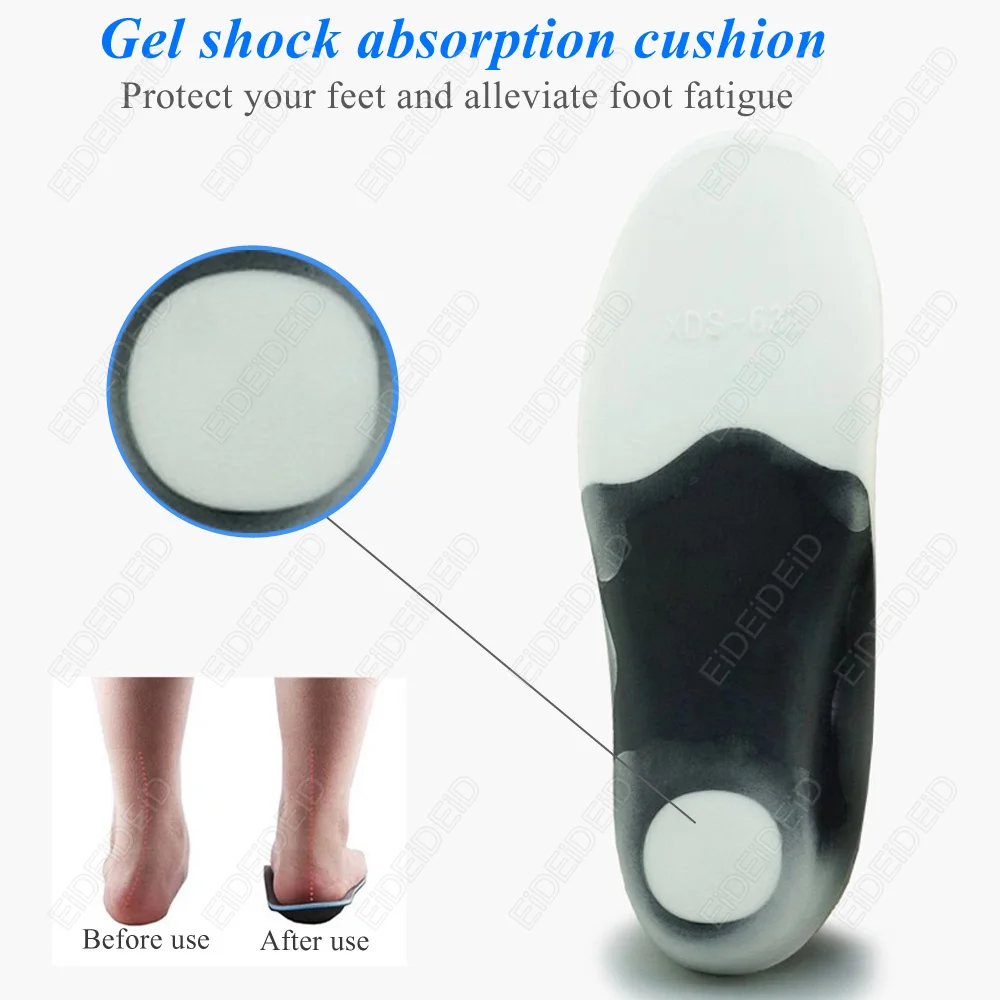 3D Orthotic Insoles Flat Feet for Kids Children and Adults Arch Support Insole for X Legs Orthotic Shoe Heel Pad Inserts