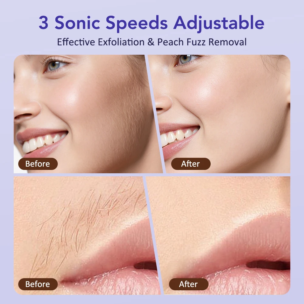 Sonic Dermaplaning Tool for Women 3-Speed Facial Exfoliation Razor Peach Fuzz Removal with 9 Refill Blades Facial Hair Trimmer