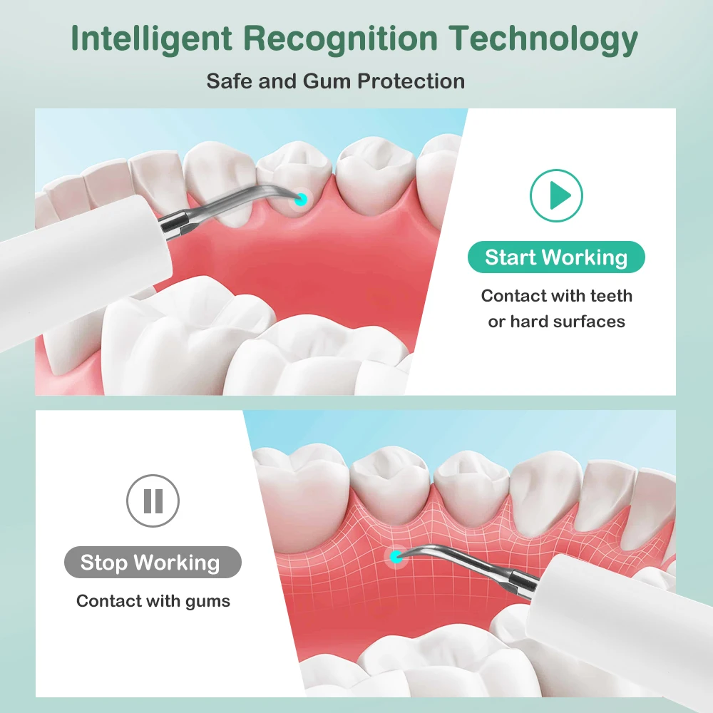 Electric Tooth Cleaner Ultrasonic Dental Scaler With 5 LED Light Plaque Calculus Tartar Remover Oral Care Teeth Cleaning Tools