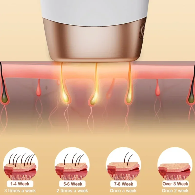 999999 Flashes IPL Laser Epilator for Women Home Use Devices Hair Removal Painless Electric Epilator Bikini Dropshipping