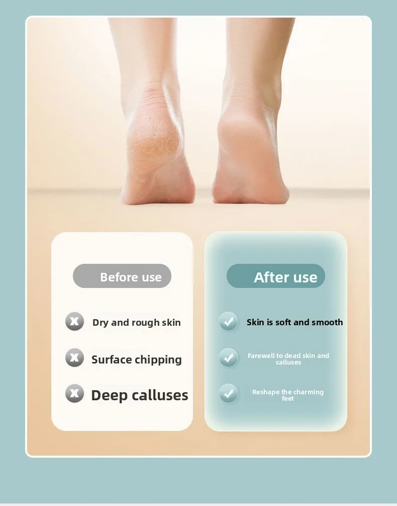 Grinding Foot Skin Electric Rechargeable Foot Grinding Artifact Remove Foot Skin Dead Skin Callus Knife Foot Trimmer