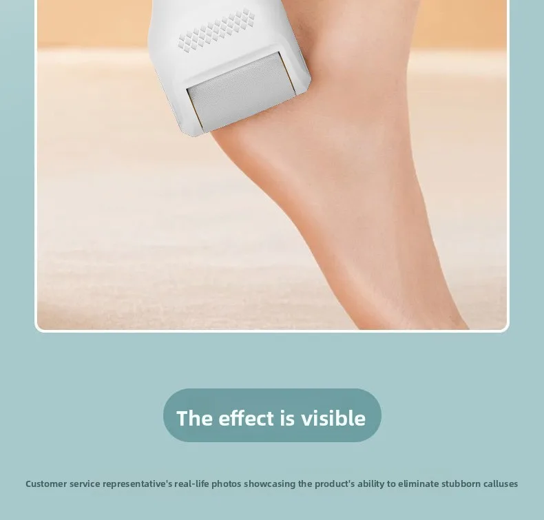 Grinding Foot Skin Electric Rechargeable Foot Grinding Artifact Remove Foot Skin Dead Skin Callus Knife Foot Trimmer