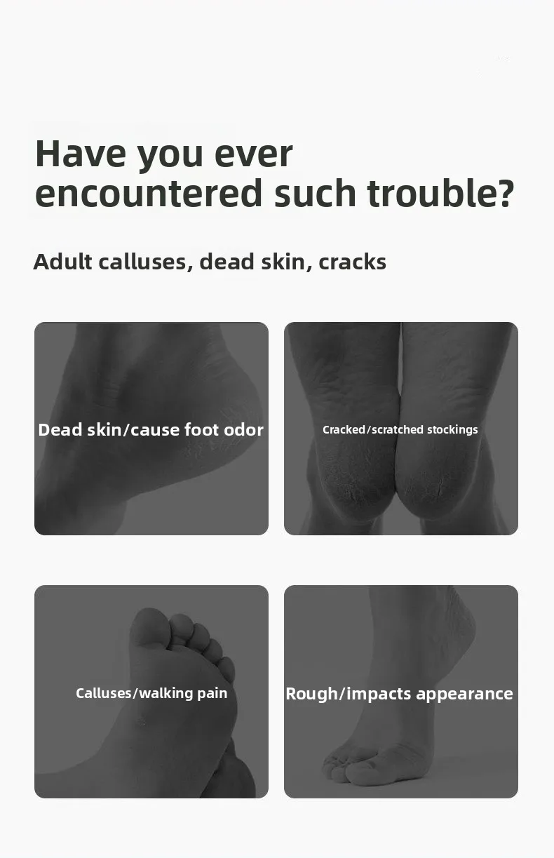 Grinding Foot Skin Electric Rechargeable Foot Grinding Artifact Remove Foot Skin Dead Skin Callus Knife Foot Trimmer