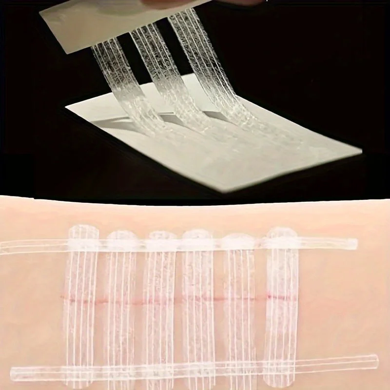 1PC Sterile Strip First Aid Travel Wound Skin Closures Medical Surgical Adhesive