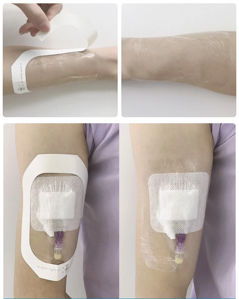 50Pcs Medical Transparent IV Cannula PU Film Sterile Waterproof Self-adhesive Wound Dressing Indwelling Needle Catheter Fixation