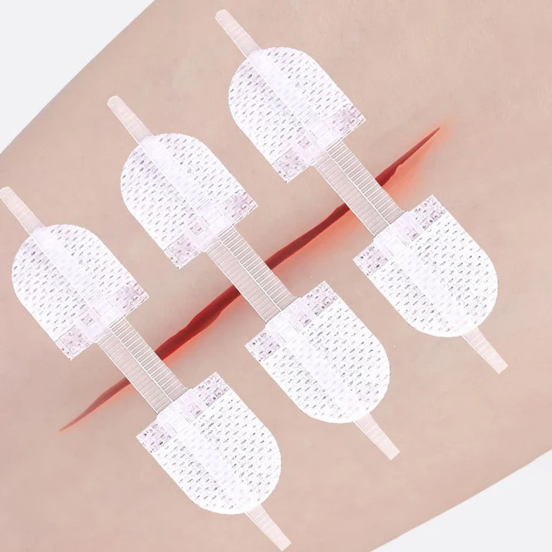 For Wound Care Braces Supports Strap Zipper Wound Closure Patches Breathable Seamless Elastic Zip Sutures Bandages