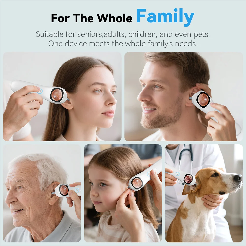 1080P HD Ear Camera 5-in-1 Smart Detector with Screen Ear Scoop Set 6 Replacement Ear Scoops 12 Replacement Check Heads Ear Tool