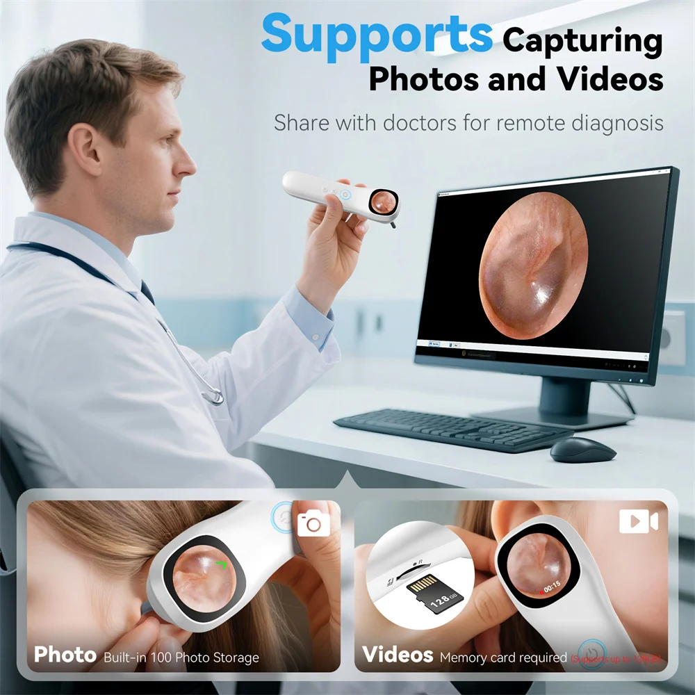 1080P HD Ear Camera 5-in-1 Smart Detector with Screen Ear Scoop Set 6 Replacement Ear Scoops 12 Replacement Check Heads Ear Tool