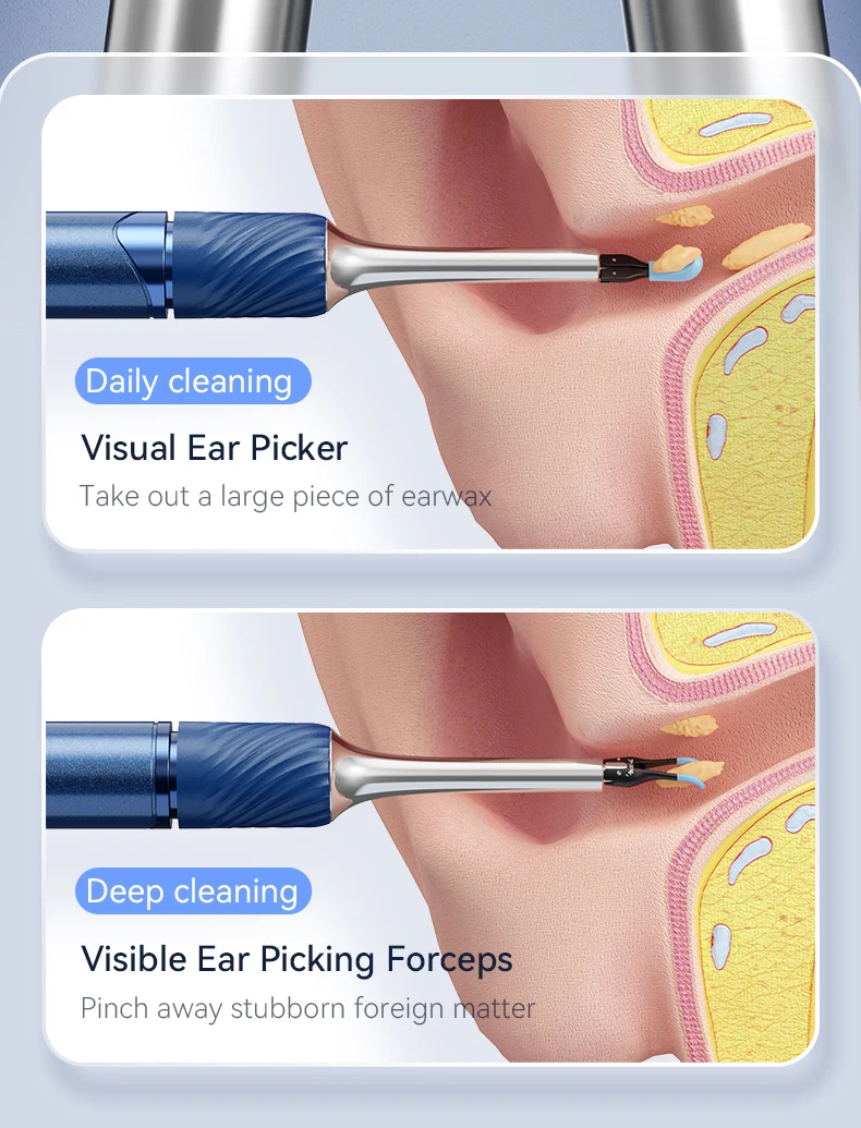 3 in 1 Wi-Fi Enabled Ear Pick Tweezers 12MP Camera Earwax Removal Tool with Rechargeable Battery Ear Cleaner with Tweezers Tools