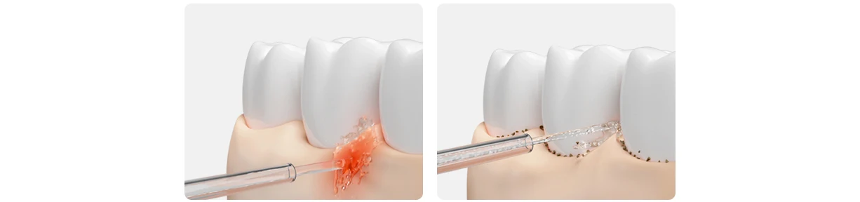 MIJIA Electric Oral Irrigator Upgraded Version – Ultrasonic, 90-Day Gentle Use, Water Flosser Dental, 3 Modes, 200mL Tank