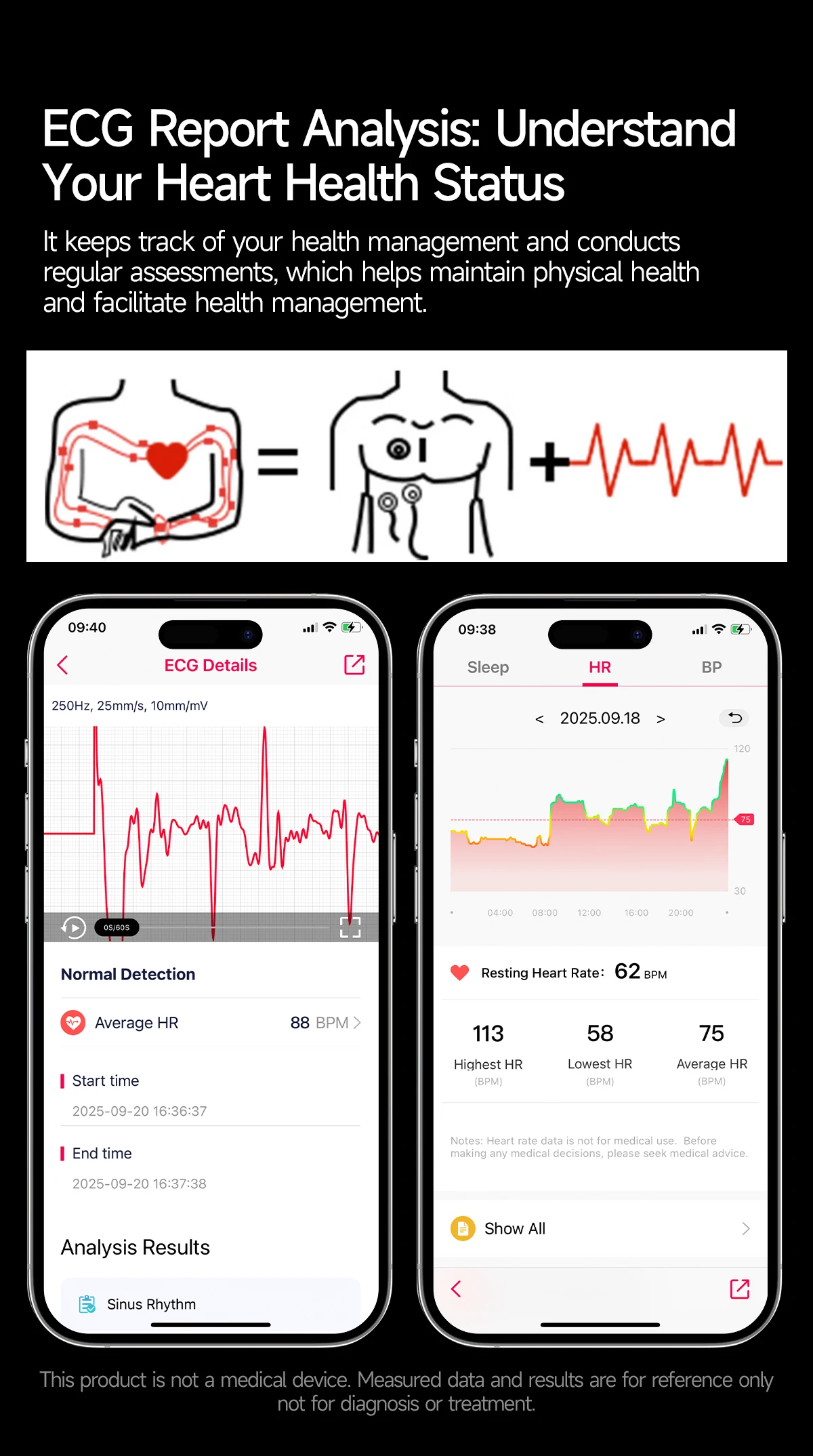 2026 New AI-Diagnosis Care Smartwatch ECG+PPG Accurate Uric Acid Blood Pressure Body Fat Five Organ Fitness Waterproof Smartwatc