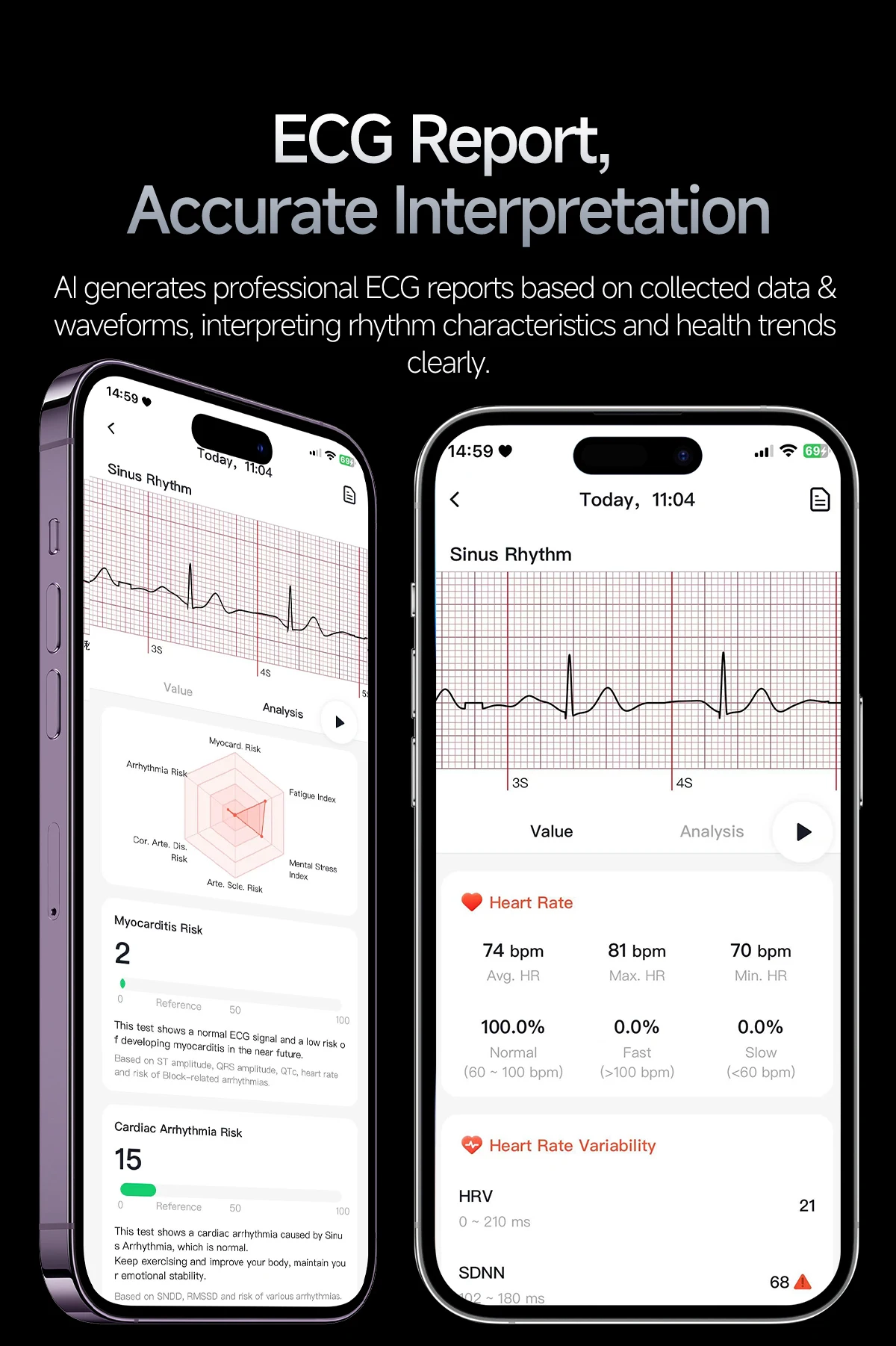 2026New Nursing-Grade AI ECG Smart Watch 1.53''Sapphire Glass Heart Rate Blood Lipid Uric Acid Monitor Bluetooth Call Smartwatch