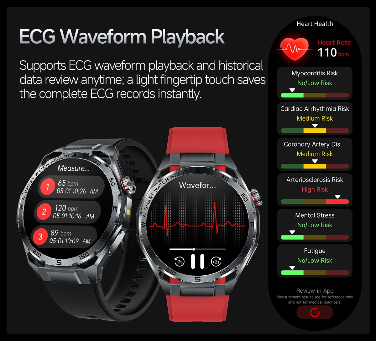 2026New Nursing-Grade AI ECG Smart Watch 1.53''Sapphire Glass Heart Rate Blood Lipid Uric Acid Monitor Bluetooth Call Smartwatch