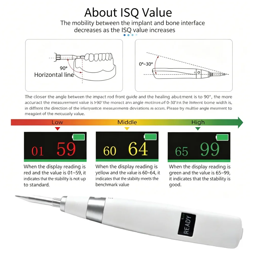 AG Dental Implant Monitor Oral Implant Stability Measurement Device Dentistry Detector Tools