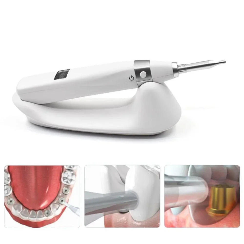 AG Dental Implant Monitor Oral Implant Stability Measurement Device Dentistry Detector Tools
