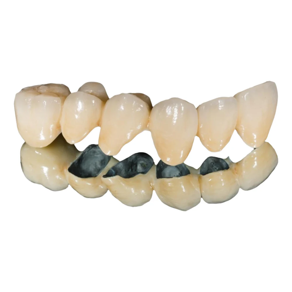 OEM Custom Dentures Fixed Restorations CAD/CAM Multilayered Zirconia IPS e.Max Veneer Post PFM Co-Cr Alloy FMC Bridge