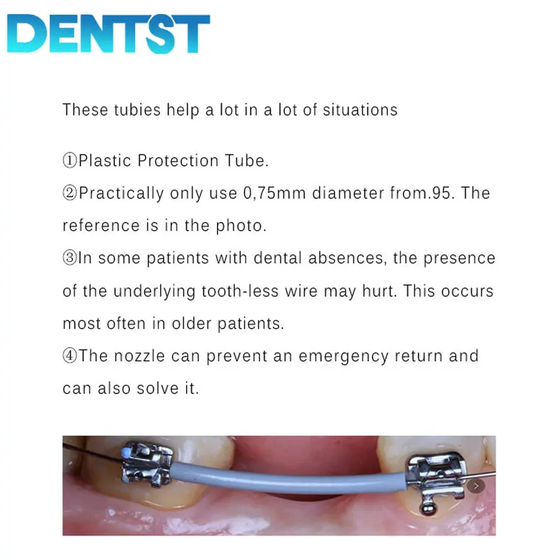 2 Roll Dental Elastic Archwire Sleeve Tubing Orthodontic Wire Protect SleeveTubing Rotary Torsion Pad for Brackets Ortodoncia