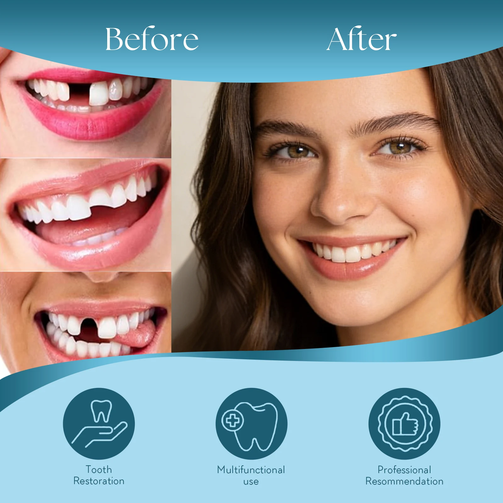 DIY Temporary Denture Kit with Upper & Lower False Teeth, Wax Strips & Gypsum Models, Reusable Teeth Restoration & Repair Tool
