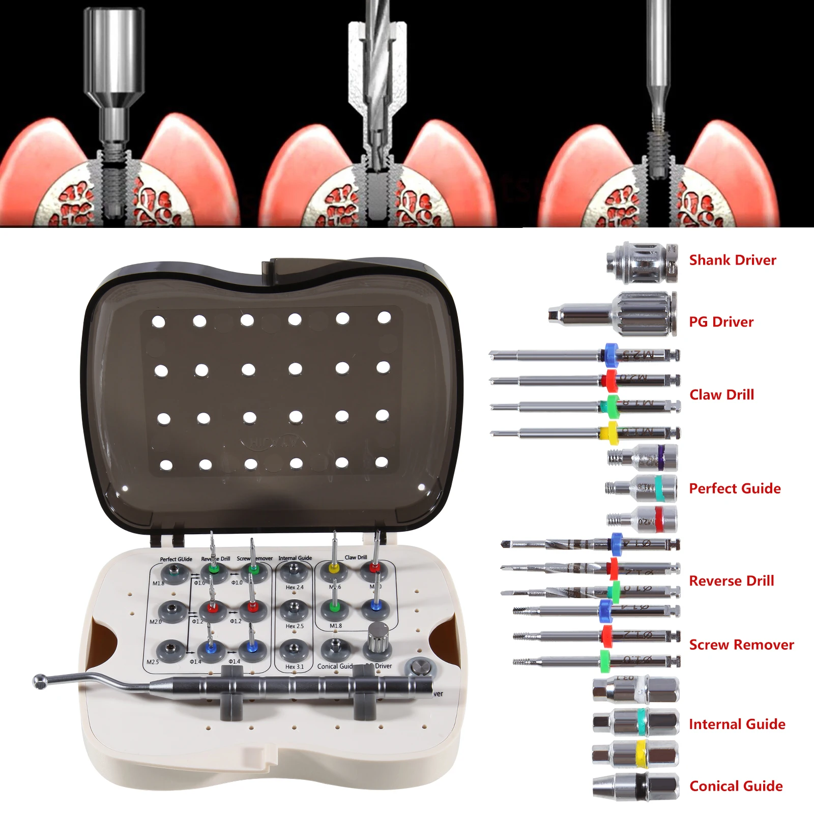 Universal Dental Implant Broken Screw Remover Kit Surgical Tool Instrument Tool Reverse Drill Guide Driver NeoBiotech